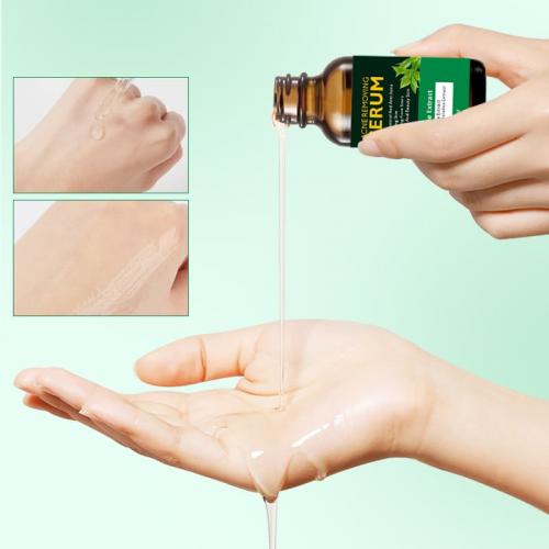 Tea Tree  Acne Treatment Face Serum